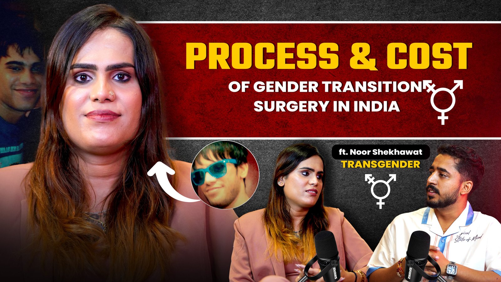 Process & Cost of gender transition surgery in india